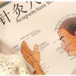 Что такое акупунктура