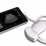 Портативный УЗИ-аппарат: преимущества и особенности использования