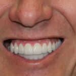 Стоматология в Ташкенте: современные услуги и качество лечения